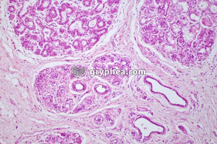 Glande mammaire active CT x40 - gryphea.com